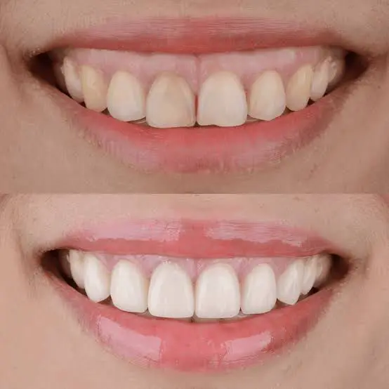 Smilecare Dental Clinic
