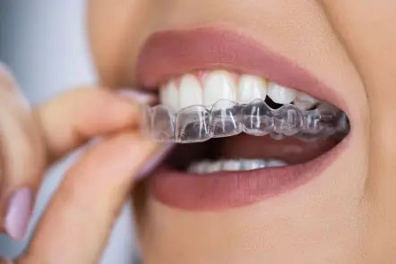 Orthodontics