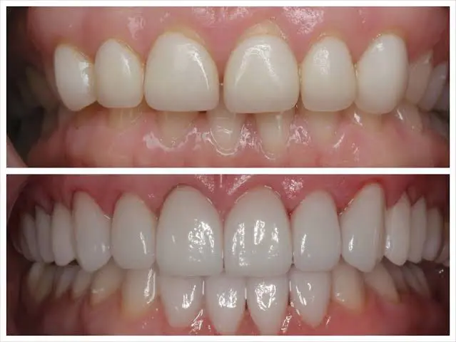 Smilecare Dental Clinic